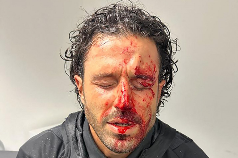 Violence dans le football : Stop ou Encore ?